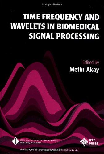 Time Frequency and Wavelets in Biomedical Signal Processing