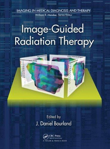 Image-Guided Radiation Therapy