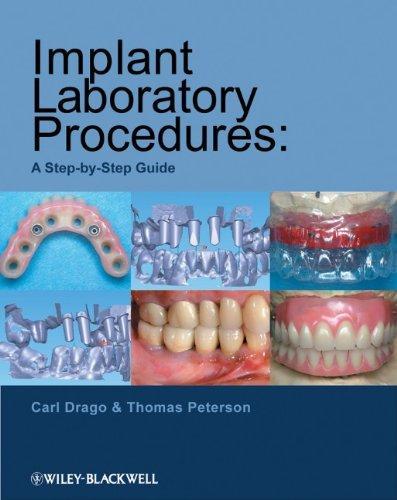 Implant Laboratory Procedures: A Step-By-Step Guide