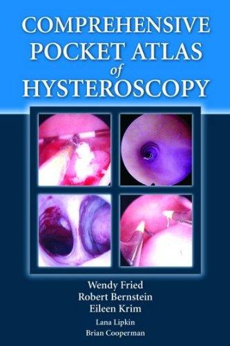 Comprehensive Pocket Atlas of Hysteroscopy