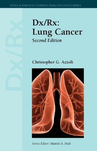 Dx/Rx: Lung Cancer (Dx/Rx Oncology)