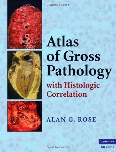 Atlas of Gross Pathology