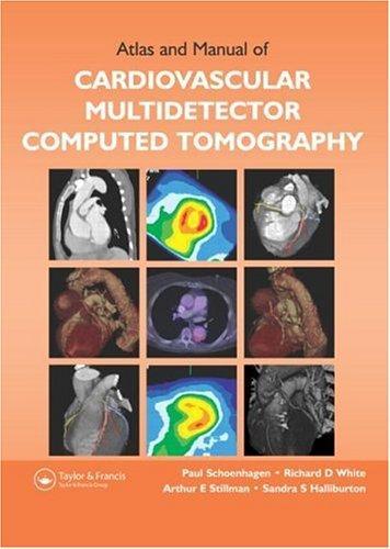 Atlas and Manual of Cardiovascular Multidetector Computed Tomography [With CDROM]