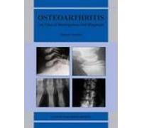 Oesteoarthritis: An Atlas of Investigation and Diagnosis 