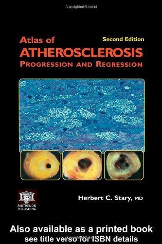 Atlas of Atherosclerosis Progression and Regression, Second Edition (Encyclopedia of Visual Medicine Series) 