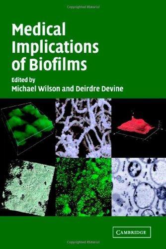 Medical Implications of Biofilms