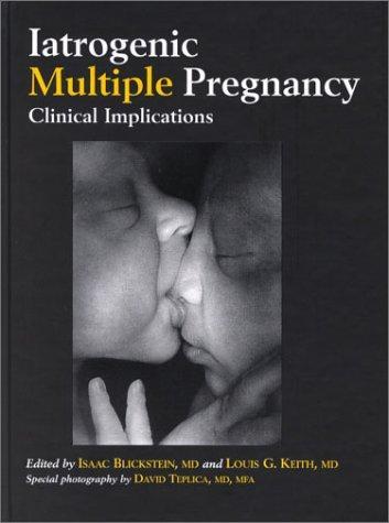 Iatrogenic Multiple Pregnancy