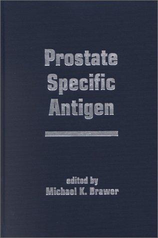 Prostate Specific Antigen