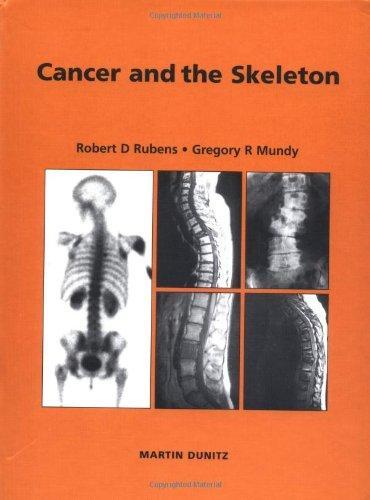 Cancer and the Skeleton 