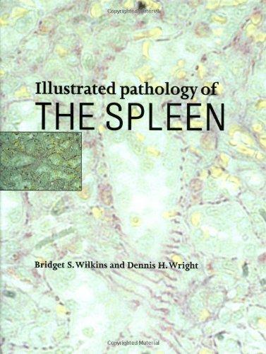 Illustrated Pathology of the Spleen