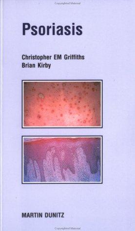 Psoriasis: Pocketbook (Martin Dunitz Medical Pocket Books)