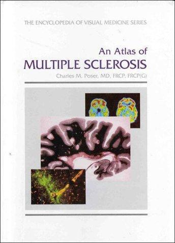 An Atlas of Multiple Sclerosis 