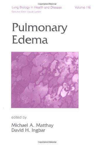 Pulmonary Edema (Lung Biology in Health and Disease) 