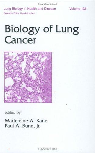 Biology of Lung Cancer (Lung Biology in Health & Disease) (Lung Biology in Health and Disease) 