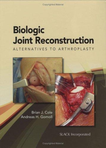 Biologic Joint Reconstruction: Alternatives to Joint Arthroplasty