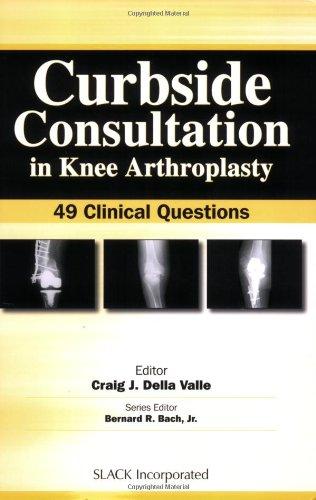 Curbside Consultation in Knee Arthroplasty: 49 Clinical Questions