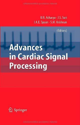 Advances in Cardiac Signal Processing