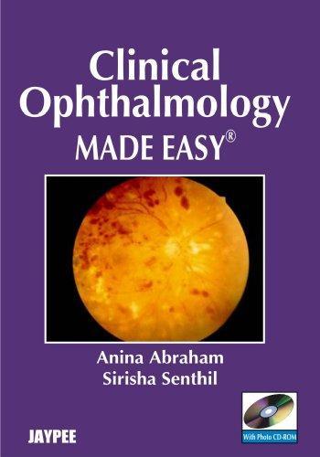 Clinical Ophthalmology Made Easy with Photo CD-ROM