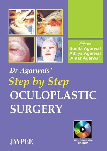 Dr. Agarwal's Step by Step Oculoplastic Surgery with CD-ROM 