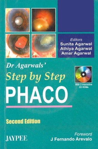 Dr. Agarwals Step By Step Phaco