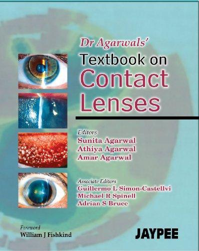 DR. AGARWAL'S TEXTBOOK OF CONTACT LENSES, 2005