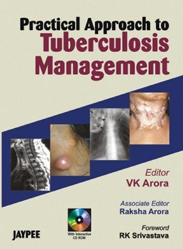 Practical Approach To Tuberculosis Management With Cd