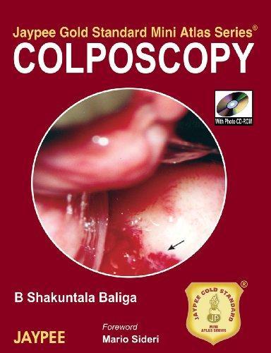 Jaypee Gold Standard Mini Atlas Series Colposcopy with DVD-ROM