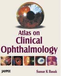 Atlas on Clinical Opthalmology