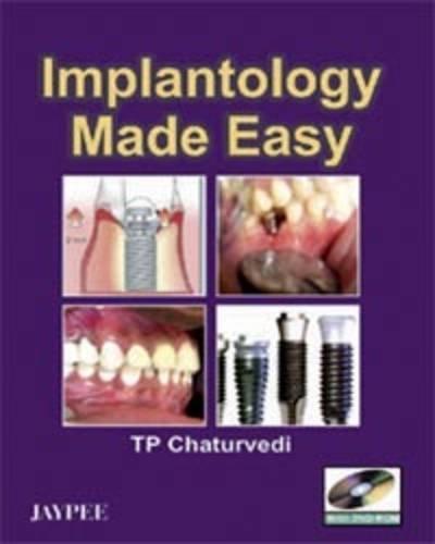 Implantology Made Easy (With DVD-ROM)