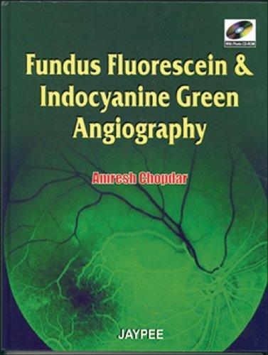 FUNDUS FLOURSCEIN & INDOCYANINE GREEN ANGIOGRAPHY WITH PHOTO CD-ROM:2007