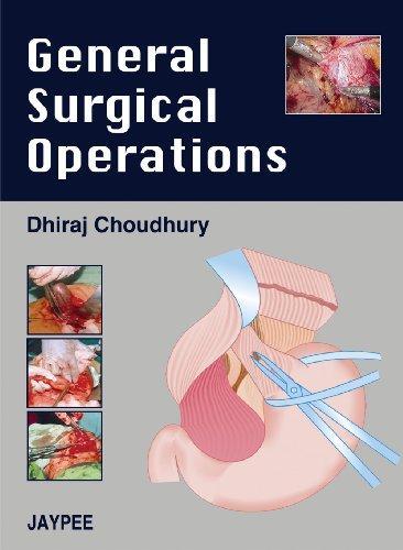 General Surgical Operations