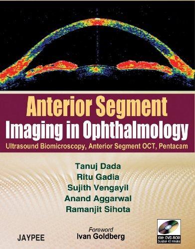 Anterior Segment Imaging in Ophthalmology with DVD-ROM