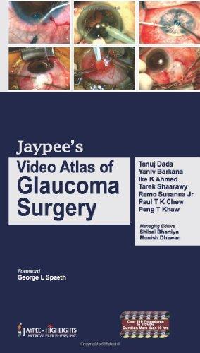 Jaypee's Video Atlas of Glaucoma Surgery