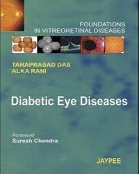 Diabetic Eye Diseases Foundations in Vitreoretinal Diseases