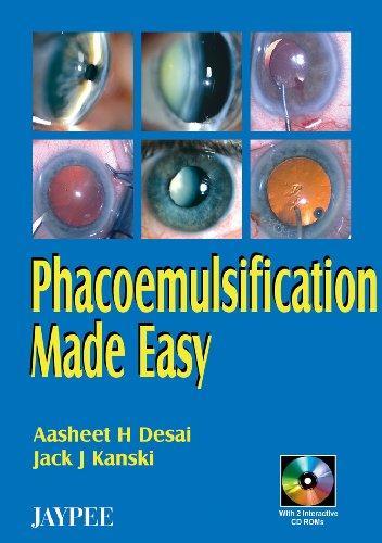 Phacoemulsification Made Easy with 2 CD-ROMs