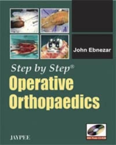 Step By Step Operative Orthopaedics with Photo CD-ROM