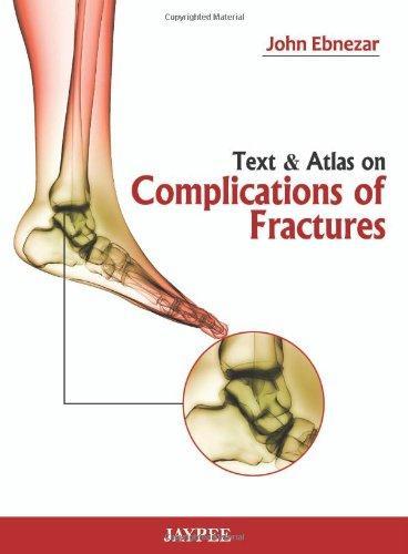 Text & Atlas on Complications of Fractures 