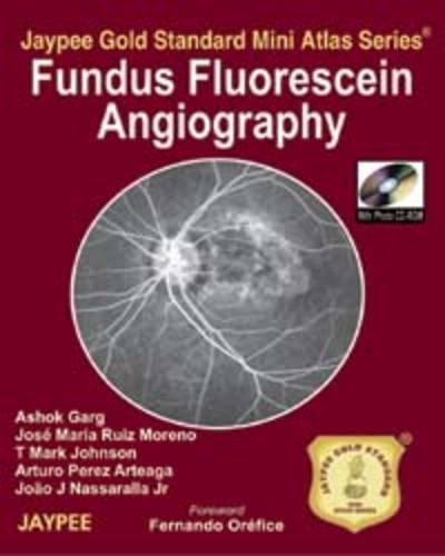 Fundus Fluorescein Angiography