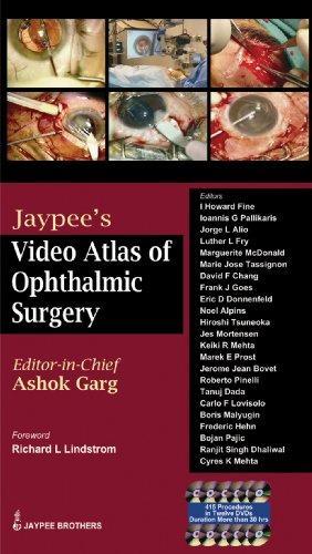 Video Atlas of Ophthalmic Surgery (Volume - 1)