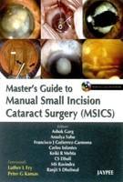 MASTERS GUIDE TO MANUAL SMALL INCISION CATARACT SURGERY ( MSICS)