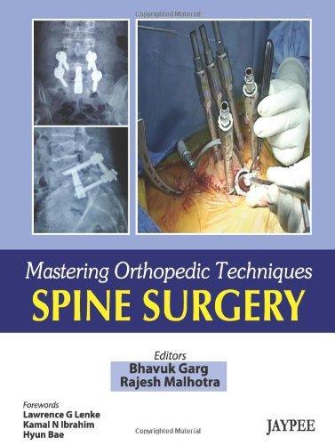 Spine Surgery (Mastering Orthopedic Techniques) 