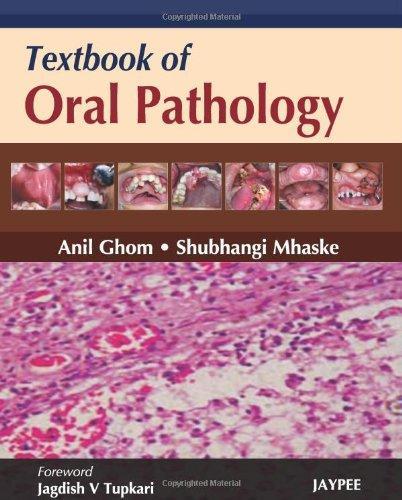 Textbook of Oral Pathology