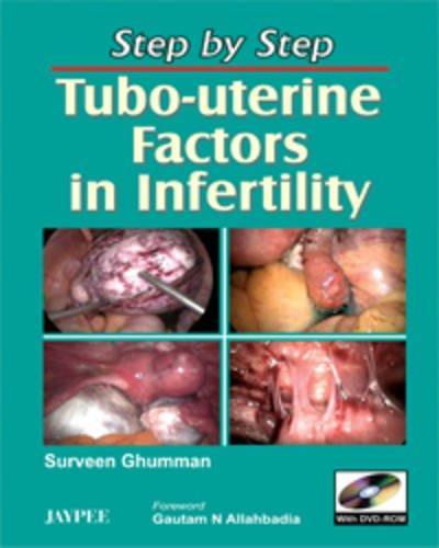 Step by Step Tubo-uterine Factors in infertility with DVD-ROM