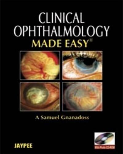 Clinical Ophthalmology Made Easy with Photo CD-ROM