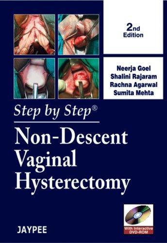 Step by Step Non-Descent Vaginal Hysterectomy