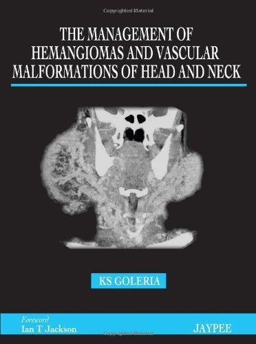 The Management of Hamangiomas and Vascular Malformations of Head and Neck