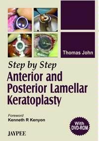 STEP BY STEP ANTERIOR AND POSTERIOR LAMELLAR KERATOPLASTY WITH DVD, 2006