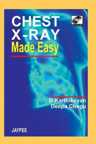 Chest X-Ray Made Easy (With Photo CD-ROM)
