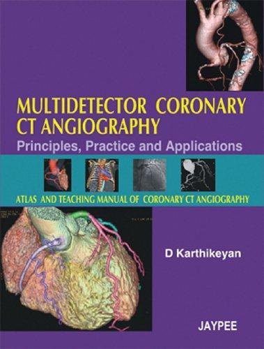 Multidetector Coronary CT Angiography