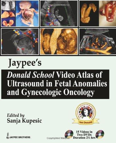 Jaypee's Donald School Video Atlas of Ultrasound in Fetal Anomalies and Gynecologic Oncology 